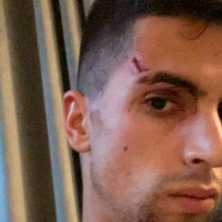 Футболиста «Манчестер Сити» избили и ограбили в собственном доме Манчестер, Сити, Отаменди, Английской, Бенфики